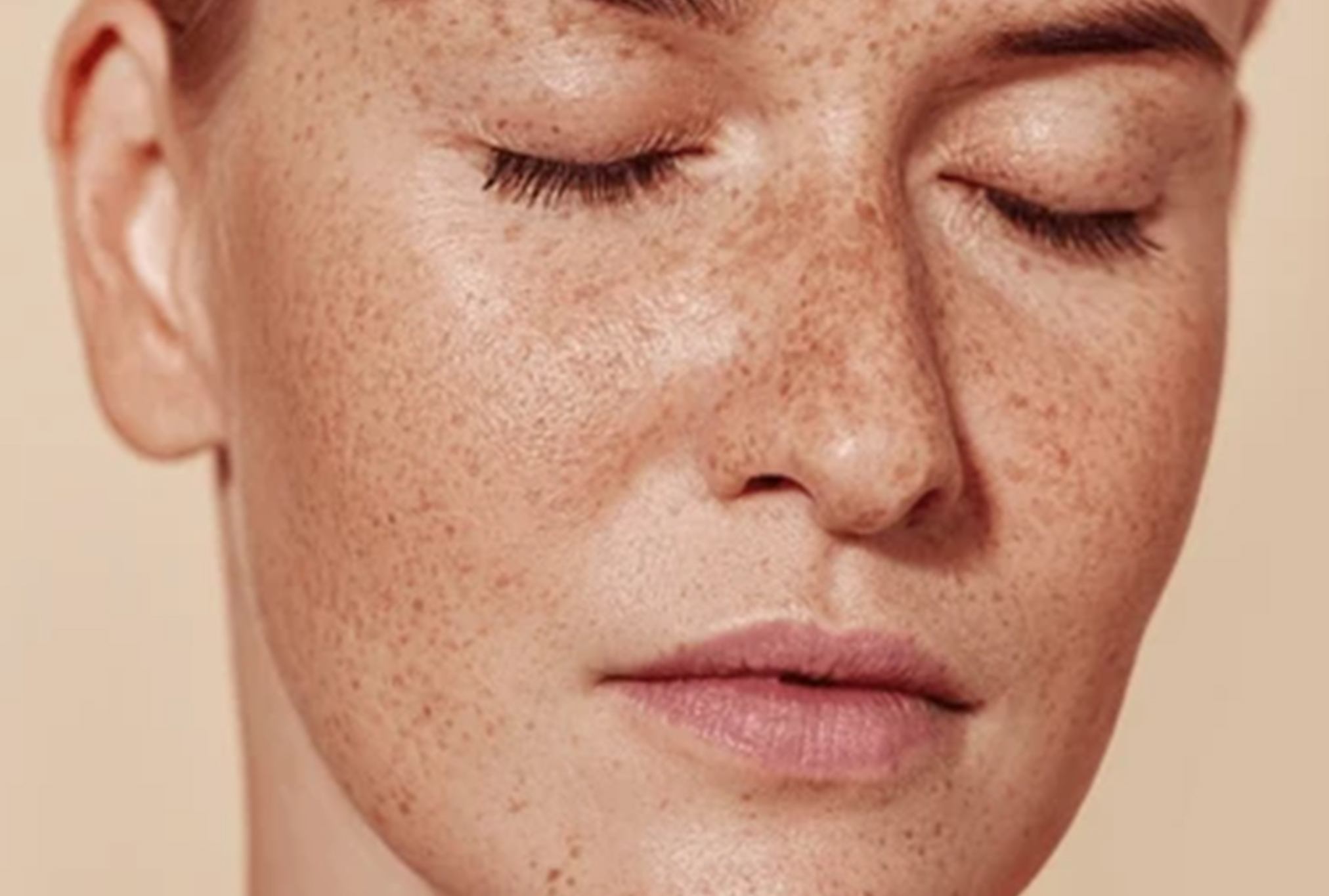 Facial Pigmentation Treatment in Malviya Nagar | Varsity Clinic