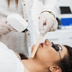 laser Treatment